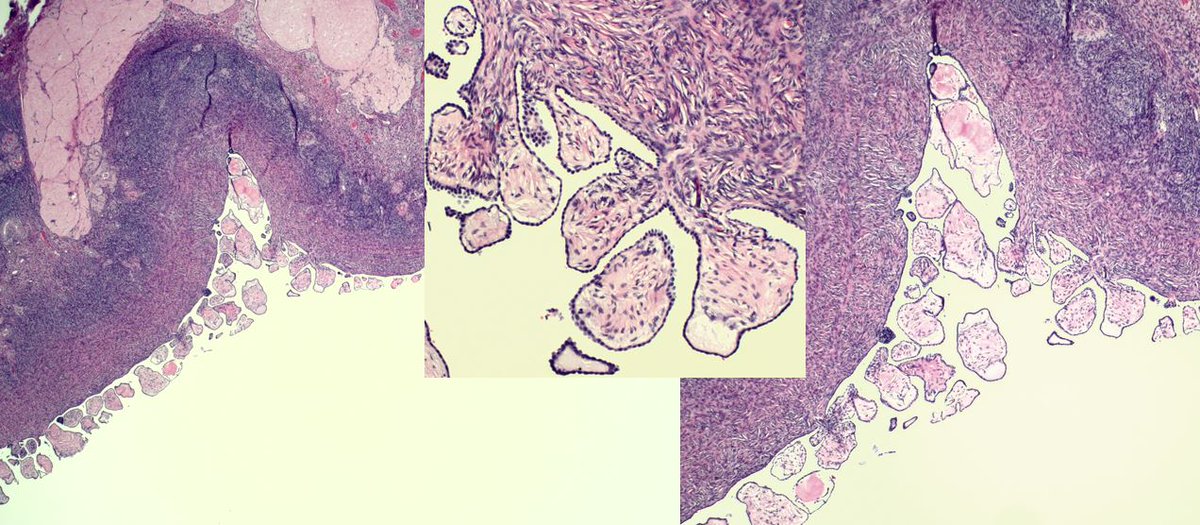 pathothama tweet picture