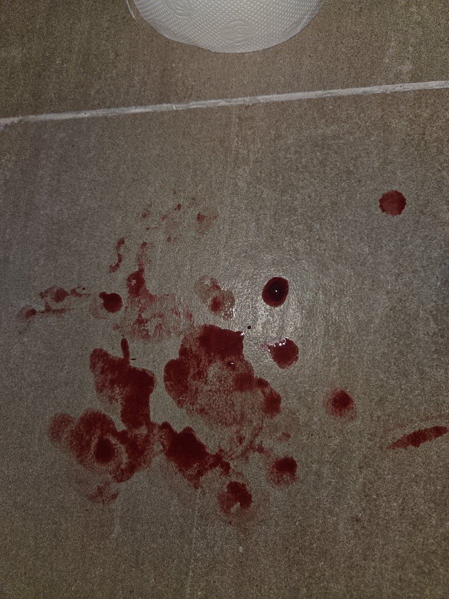 c37hv's tweet photo. #shtwt  #shtwtt  #shwtt  #sfxmakeup  #sfx 

! FAKE BLOOD ! https://t.co/v4tWmfqHe0