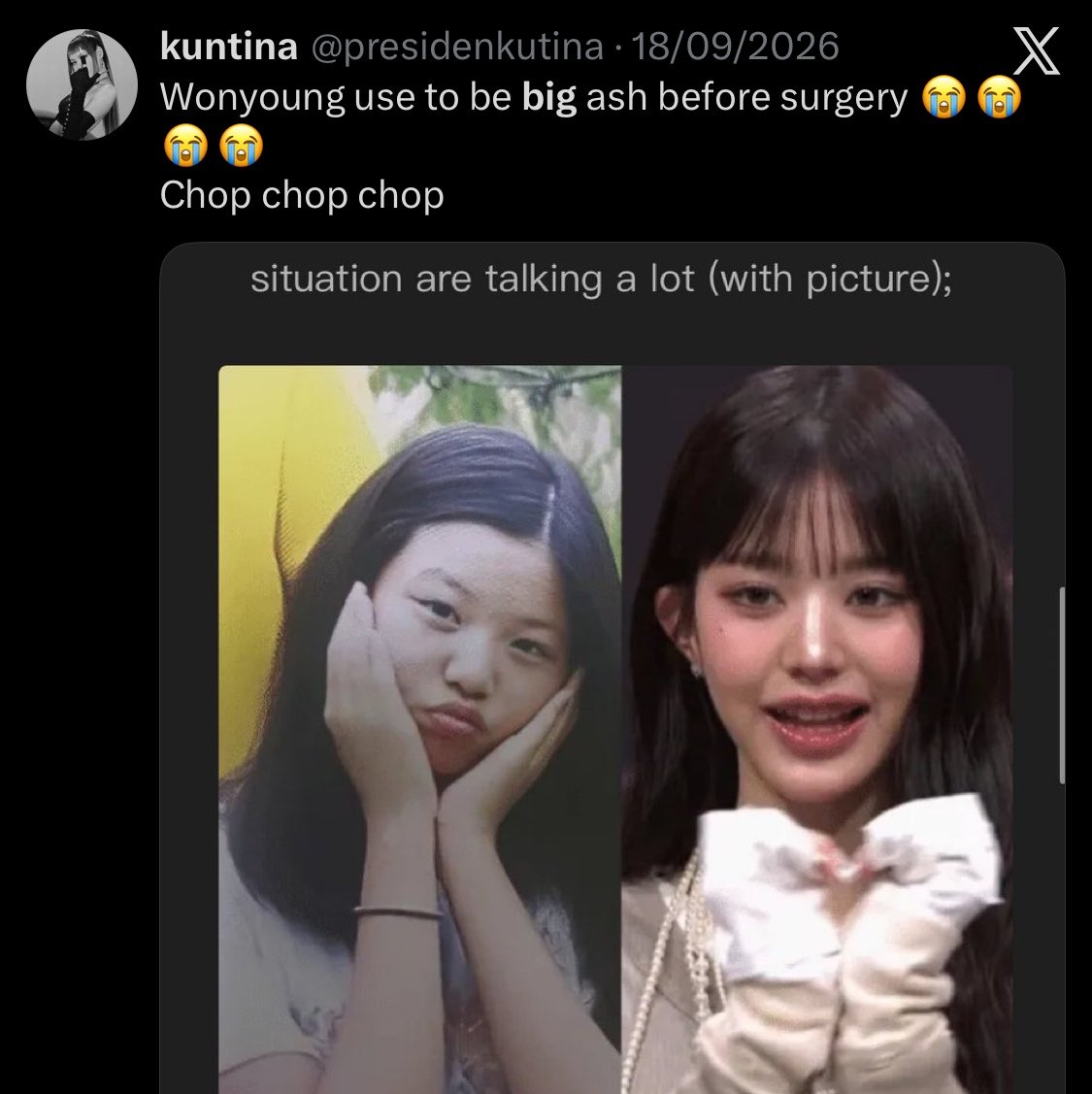 needy4miso's tweet photo. kpop stans love body shaming women into getting thinner and then have the nerve to act stunned when they actually lose weight and start looking skeletal. https://t.co/bUMFfXa2P3