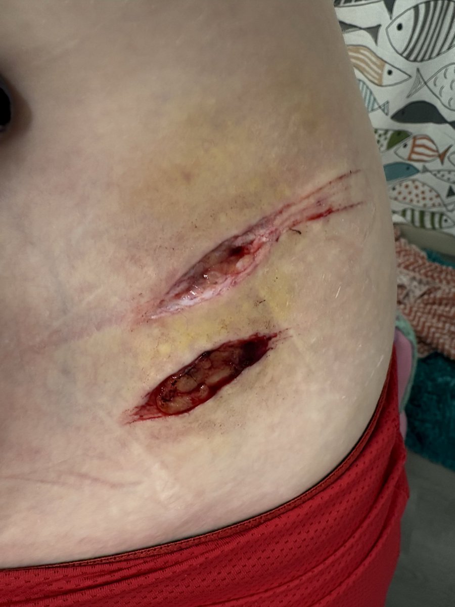 selfbruised's tweet photo. updatw https://t.co/04mkXr39Uy