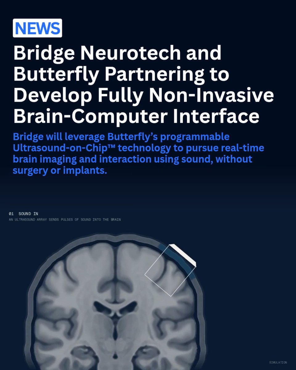 A news announcement stating 'Bridge Neurotech and Butterfly Partnering to Develop Fully Non-Invasive Brain-Computer Interface', with a simulation image showing an ultrasound array sending sound pulses into a brain.
