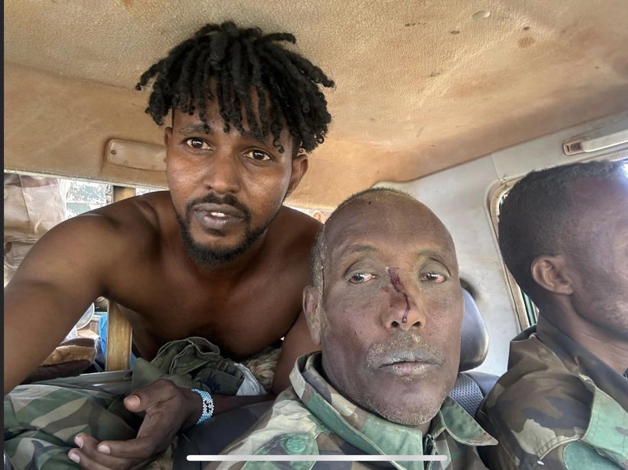 QalasTuke's tweet photo. @HHokariye Gaal Raac Yahuud if Isxaar💩🇮🇱landers know how fight how come ur terrorist militia’s were defeated by Qalas🐎teenagers with no training nor weapons they 💀☠️ &amp; disarmed ur terrorist militias took the weapons international community has given to Isxaar💩🇮🇱land &amp; we took slaves! https://t.co/5rtYzNf0Jo