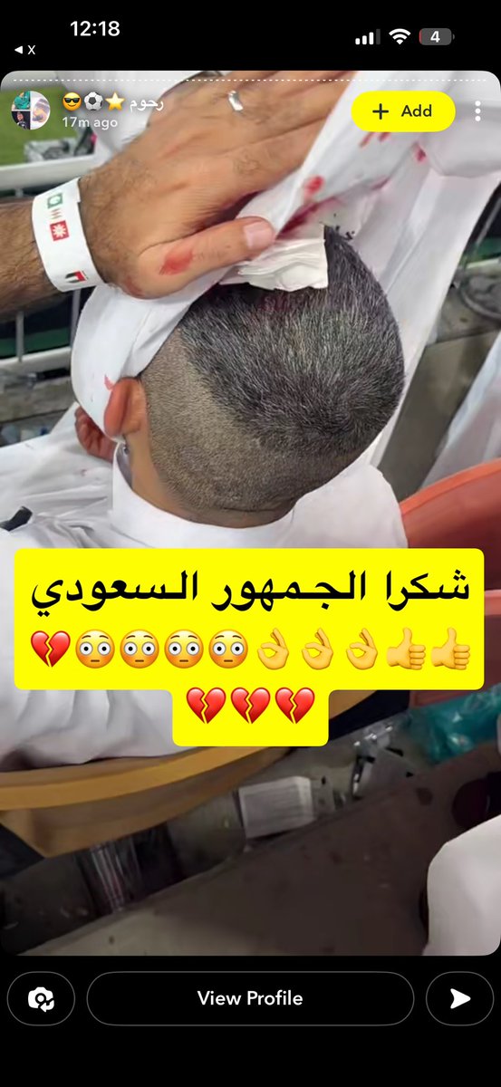 lm9rss's tweet photo. حسبي الله عليكم يالتعاووسه يالهمج https://t.co/njTcZgA40x