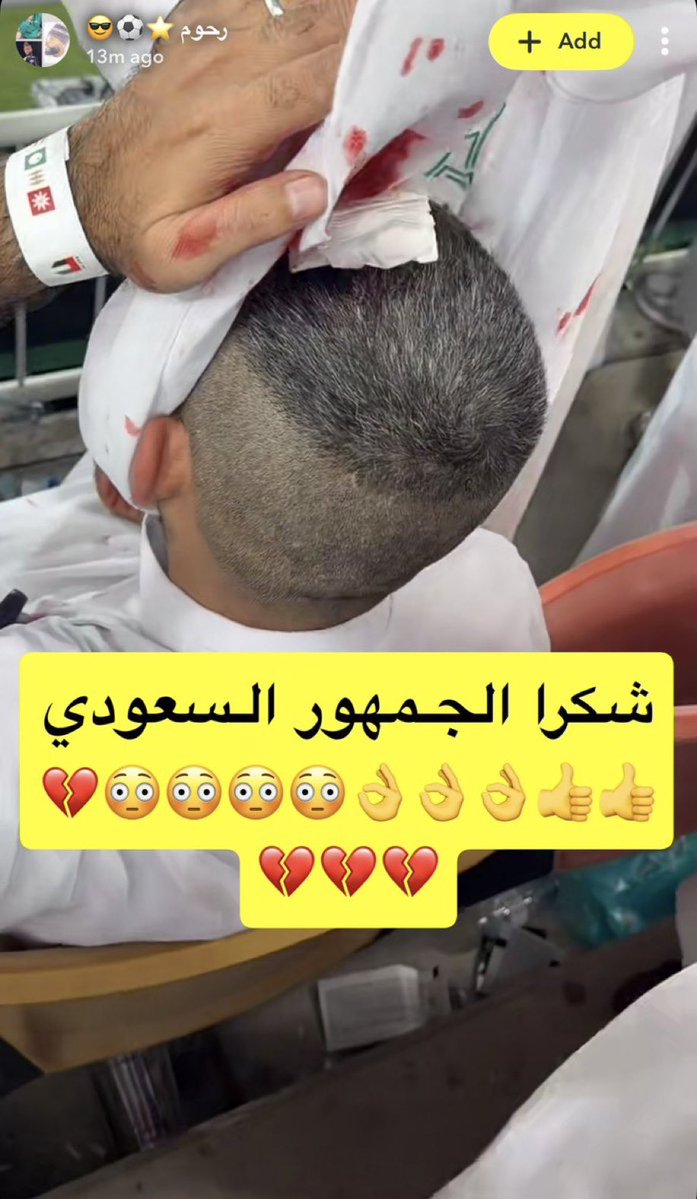 _oxox39's tweet photo. فـزتوا بـ البطوله، ونحن فـزنا بـ اخلاقنا وتـربيتنا

الله يردكم سالمين ياعيال زايد
ويحفظكم من كل شر يارب https://t.co/taAY5YDvs1