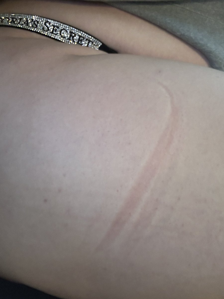 Ur_Bunniii's tweet photo. my thighs are too thick for my desk chair, everytime i stand up im dented 😵‍💫

#nswftwt https://t.co/bYdUq6QaBD