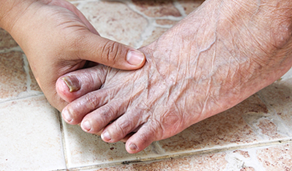 DMFootAnkle's tweet photo. Recognizing Toenail Fungus Infections dlvr.​it/TVpSh8 https://t.co/PY9FhTxqyt