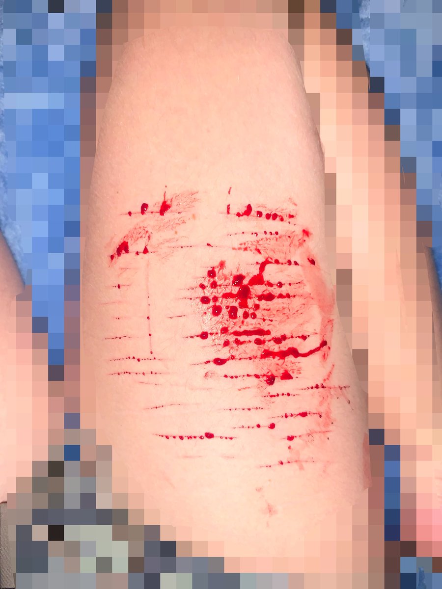 shotaxsh's tweet photo. ⚠️Sfx make up, all fake just practice for Halloween.
lmao they’re so small im gonna cry.
Aside from that im wearing my micro shorts today\>
#shtwt https://t.co/CcdKAivJ5t