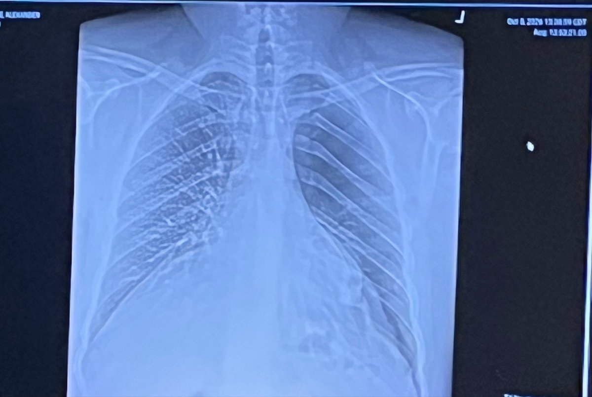 TheChaosSpirit's tweet photo. Hi guys! As @TheMrPasquale mentioned, he currently has a collapsed left lung and has been in the ER + ICU the last few days.

I’ve opened up my tip jar for anyone interested in helping us out through this. Thank you so much 💛💙

https://t.co/LEILr0RsWm https://t.co/f5Rk32RZOu