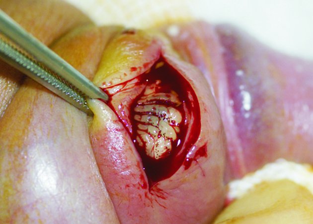 GYerathel's tweet photo. Penis with live 🐛🐛

Your health is ur wealth https://t.co/yvO5ZXzqdk
