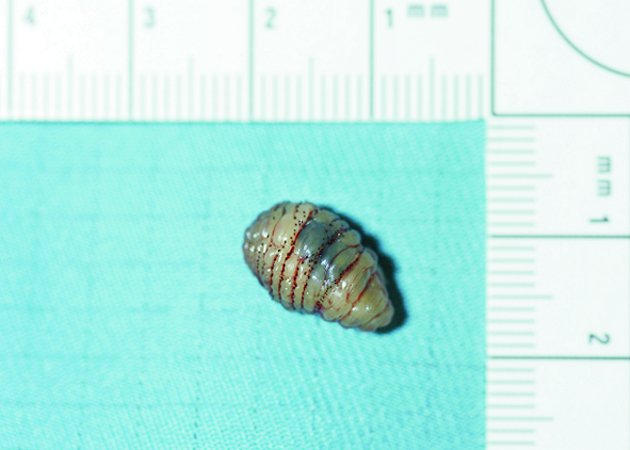 GYerathel's tweet photo. Penis with live 🐛🐛

Your health is ur wealth https://t.co/yvO5ZXzqdk