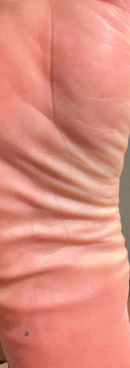goatdnillz's tweet photo. Ur favorite pattern https://t.co/7lV1M4cTMK