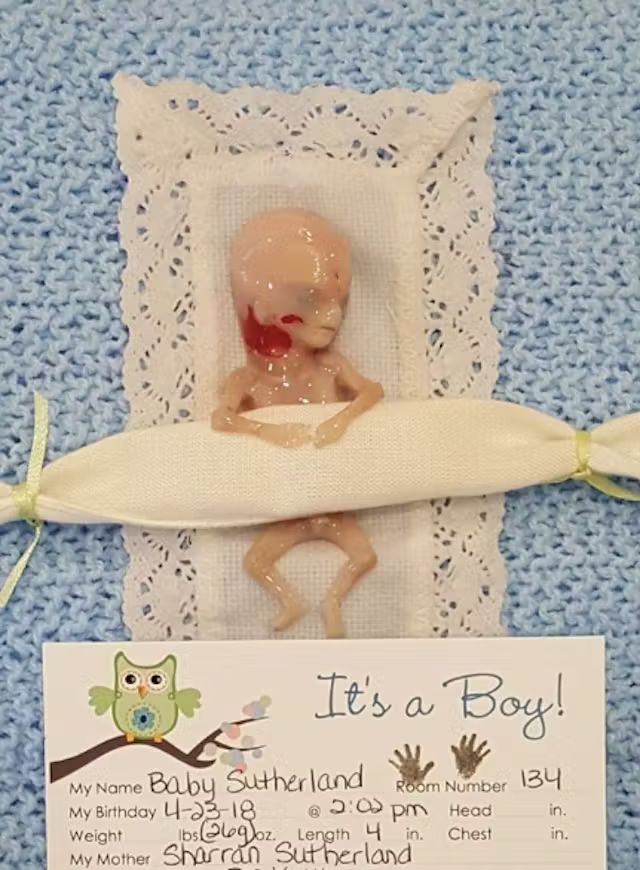 LiveActionNews's tweet photo. Baby Miran was miscarried at 14 weeks.

Then something incredible happened.

His mother bravely shared the photos of her son online, showing his “fully-formed face, hands, feet, and even fingernails.”

One of her friends rejected abortion because of the photos.

Another woman contacted her saying she cancelled her abortion appointment after reading about her son.

The life of Baby Miran may have been short, but his legacy has saved lives.