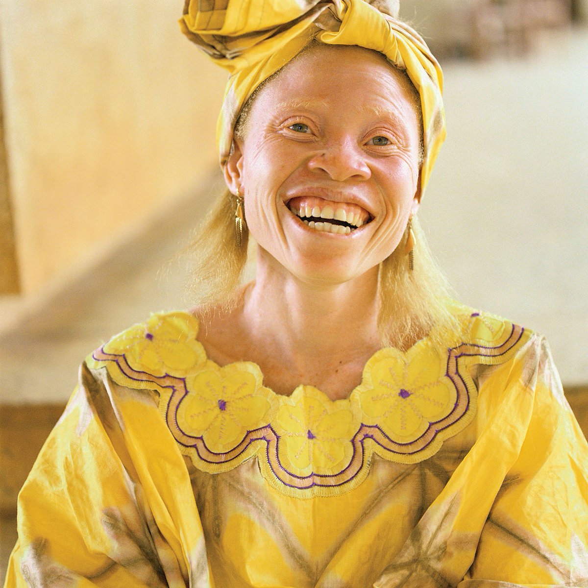 luvvybunnie's tweet photo. Do they think albinism takes away your ethnic features too orrrr https://t.co/Jb4gGjwJlT