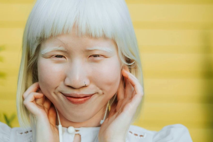luvvybunnie's tweet photo. Do they think albinism takes away your ethnic features too orrrr https://t.co/Jb4gGjwJlT