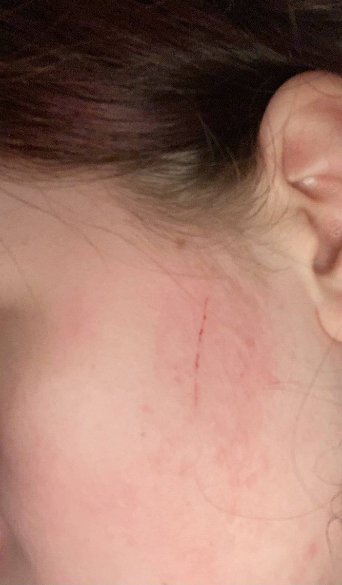 Chiyanyah's tweet photo. My cat scratched me in the face, does it count as sh if I make him do it on purpose? #shrtwt? https://t.co/92e4nVOI2V