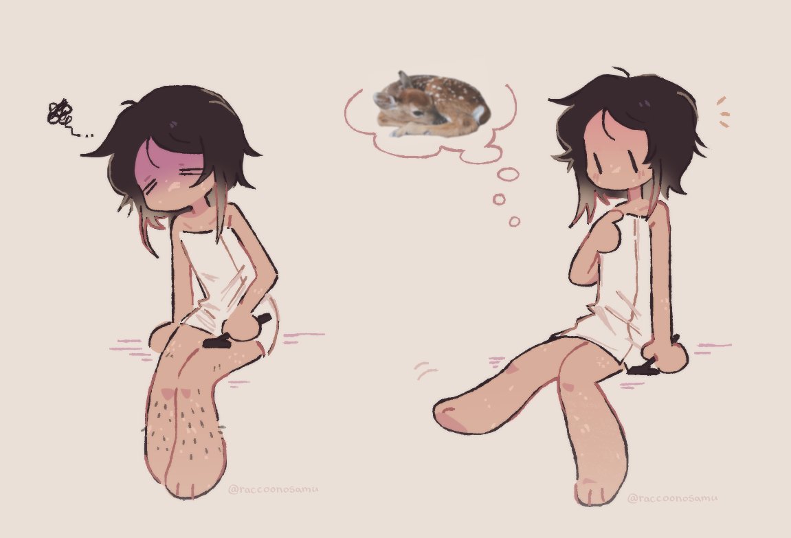 raccoonosamu's tweet photo. vitiligo actually turns u into a fawn https://t.co/p4gD1KnhrW