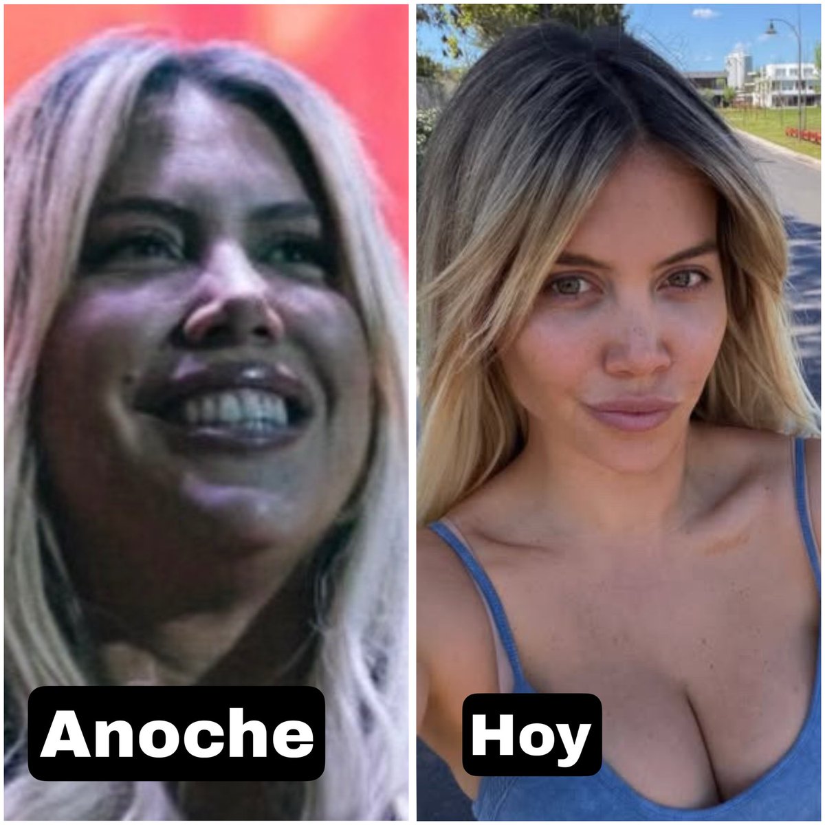 PeteFeInforma's tweet photo. LAS REDES NO PERDONAN 😂

Las internautas quedaron sorprendidas con el cambio de Wanda Nara en menos de 24 horas.

Anoche era una… hoy amaneció siendo otra. 😳

¿Magia? ¿Milagro? ¿Filtros? ¿Edición?
Misterios que la ciencia todavía intenta resolver. 

Los leemos. 🍿 https://t.co/oiqaKuYWqS