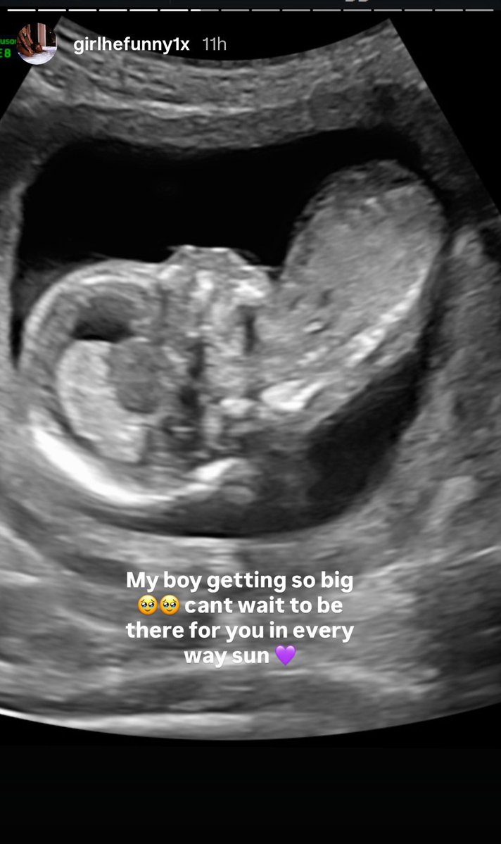 ReggieUpdate's tweet photo. Reggie shares a Update on his Son in a Ultrasound ❤️👀 https://t.co/yqWlYRkLSq