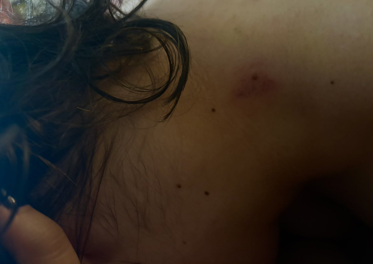 djKuntryKitty's tweet photo. puppy loves being marked 
#nsfwㅤㅤtwt #nsfwtwtًً https://t.co/3k5WVTGr32