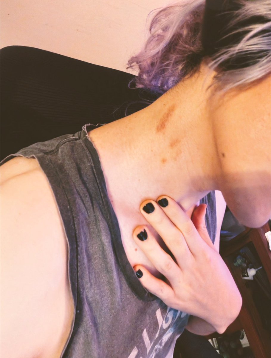 Lucenyanya's tweet photo. J'aime trop quand on me laisse des marques 😵‍💫😵‍💫😵‍💫😵‍💫 https://t.co/C3FlspodjD