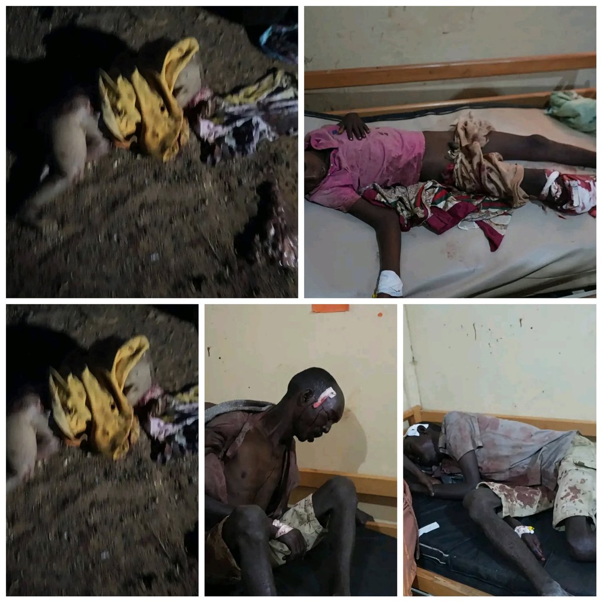 GereGere896347's tweet photo. # 2nd round of Tigraygenocide is going on. Today, Z genocidal regime of ethiopia conducted a drone strike in IDPs centre in Sheraro Town, Tigray, killed  8 civilians &amp; wounded many. 
#stoptigraygenocide 
@UN @UNHumanRights 
@antonioguterres @hrw 
@EU_Commission @amnesty https://t.co/lXfdCVRz2s