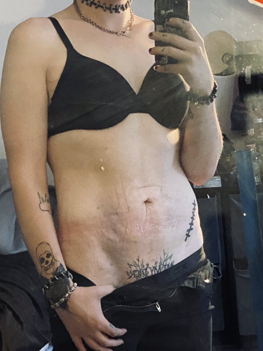josiegraves138's tweet photo. Kiss my tummy https://t.co/egYpJLgmhy
