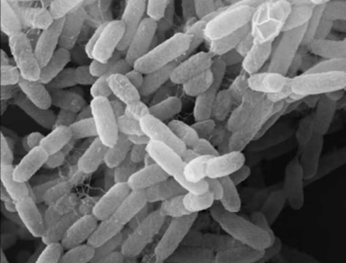 carol_perelman's tweet photo. 🙏🏻Murió una asistente de laboratorio del Instituto de Investigación Anti Plaga de Irkutsk, en la región rusa de Siberia.

👉🏻Al parecer, Daría Shipilova de 28 años falleció cuando estaba hospitalizada con neumonía causada por un “agente desconocido”. Otras fuentes indican que fue por peste pulmonar al contagiarse cuando un tubo de ensayo conteniendo la bacteria Yersinia pestis en el laboratorio de alto nivel de bioseguridad (BSL-3) donde trabajaba, aparentemente se cayó y rompió. Aún no hay claridad ni confirmación.

🏥Lo que sabemos es que hay ~200 personas y 5 hospitales en cuarentena y según reportes nadie ha salido positivo a las pruebas de peste.

🫁Si bien la forma pulmonar de la peste es contagiosa entre personas a través de gotículas inhaladas (no muy contagiosa, R0 = 1.3), es una enfermedad bien conocida y de rápida progresión, pero su alta mortalidad disminuye con antibióticos administrados oportunamente.

🐀Esta misma bacteria da otras dos formas de peste: la bubónica que se transmite por picadura de pulga que habita principalmente en ratas, y que causó la Peste Negra durante la Edad Media matando a 1/3 de la población europea -no había antibióticos, ni vacunas-, y la septicemia por contacto o complicación. 

🧫Es una bacteria con varios reservorios animales, por lo cual cada año hay casos aislados de peste en el mundo. Sin embargo, hoy desconocemos si el contagio surgió del supuesto accidente en lab y si fuera el caso, sobre el perfil de la bacteria con que el estaban trabajando. 

ℹ️Esperemos las notificaciones oficiales; no debemos ahorita caer en comunicados amarillistas, especulativos, ni fatalistas. 

🙌🏻Aclaremos:
Contra esta bacteria tenemos antibióticos, vacunas y pruebas diagnósticas. 🙏🏻🙌🏻