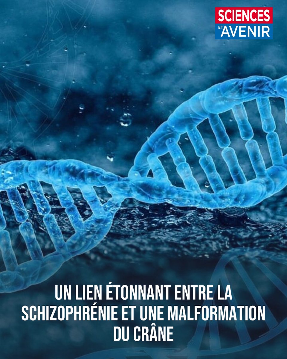 Sciences_Avenir's tweet photo. Selon une étude, le développement de la schizophrénie pourrait être lié à une malformation crânienne chez les patients atteints du syndrome de délétion 22q11.2, une anomalie chromosomique.
👉 https://t.co/LAXVnpNNua https://t.co/EOiuXhaVVo