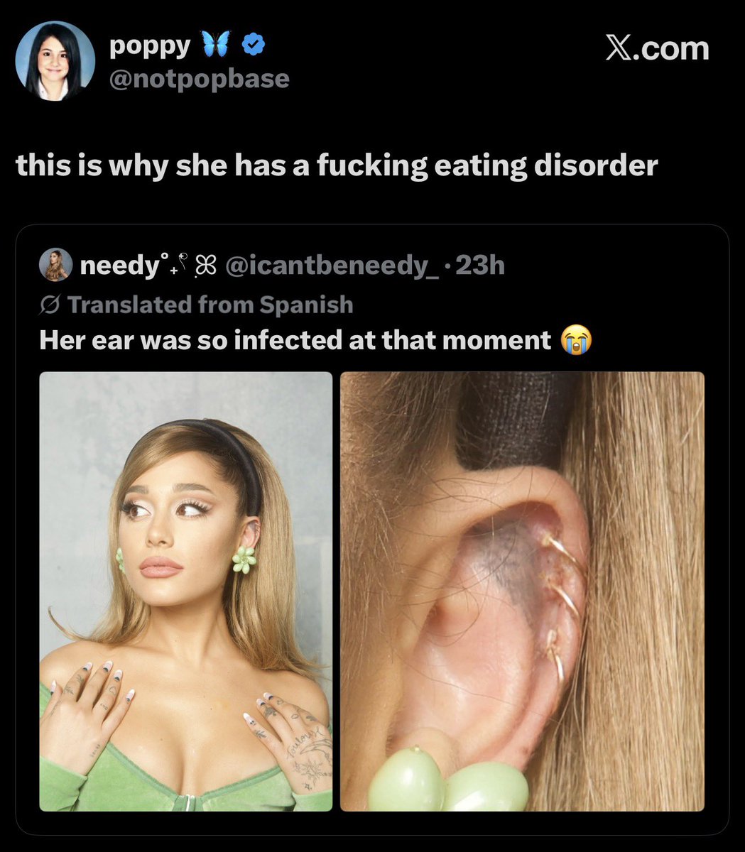erenfromtargets's tweet photo. poppy retarded asf https://t.co/MOAVOfX4B4