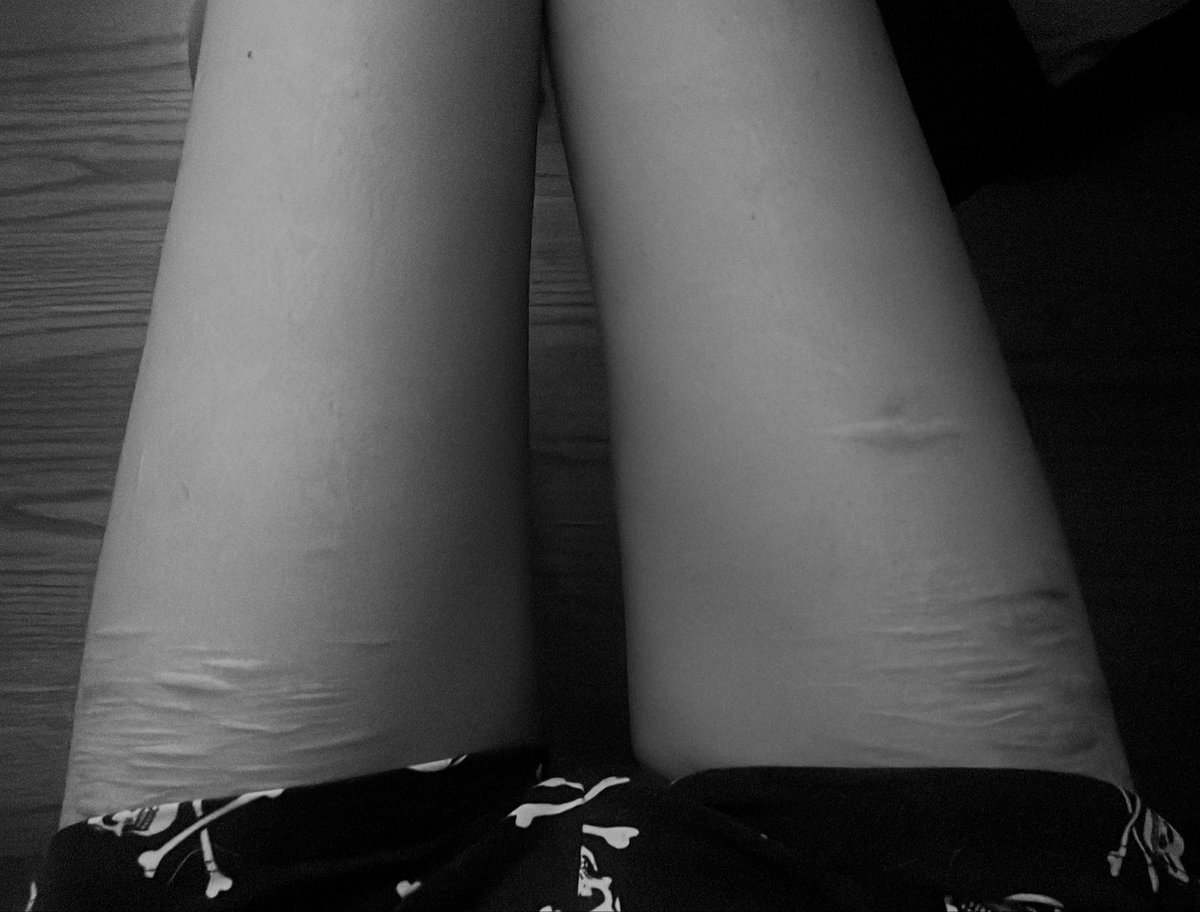 xanoholic's tweet photo. Bru I wish my thighs looked like this while sitting down https://t.co/ERBgIvqSpI