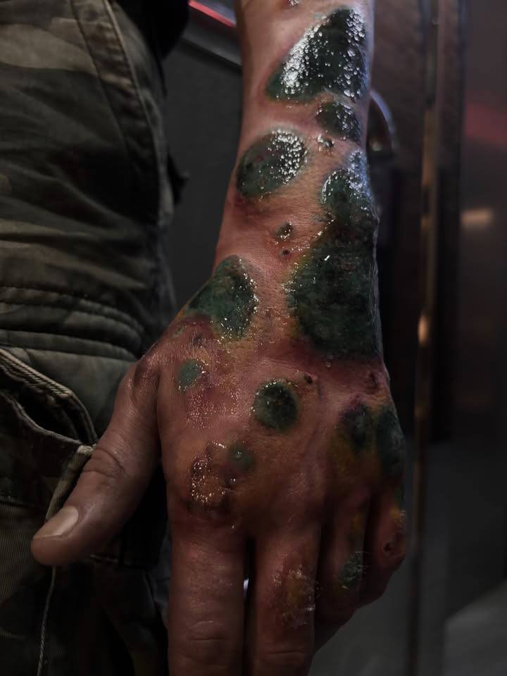 Carolus_XII_Rex's tweet photo. 🇷🇺Moscow: Gen Z are queuing for viral tattoos that make their skin look moldy, infected and literally rotting. https://t.co/XlpjnTxQPL