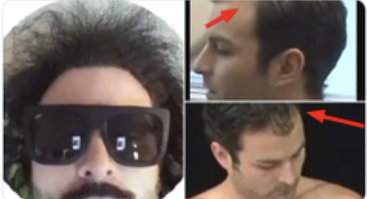 GewCannon's tweet photo. @NSWarmachine hair dye doesn’t give you nigger hair for years in your 30’s man. it also shouldn’t make your hair fall out but luckily shoobie was able to get some hair plugs thankfully. now he can continue to lie and larp as a scottish german :) https://t.co/SqJ8lpqO5m
