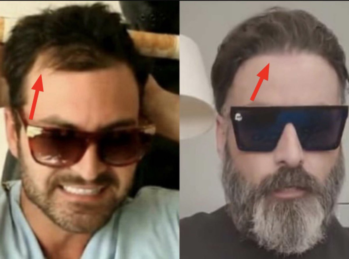 GewCannon's tweet photo. @NSWarmachine hair dye doesn’t give you nigger hair for years in your 30’s man. it also shouldn’t make your hair fall out but luckily shoobie was able to get some hair plugs thankfully. now he can continue to lie and larp as a scottish german :) https://t.co/SqJ8lpqO5m