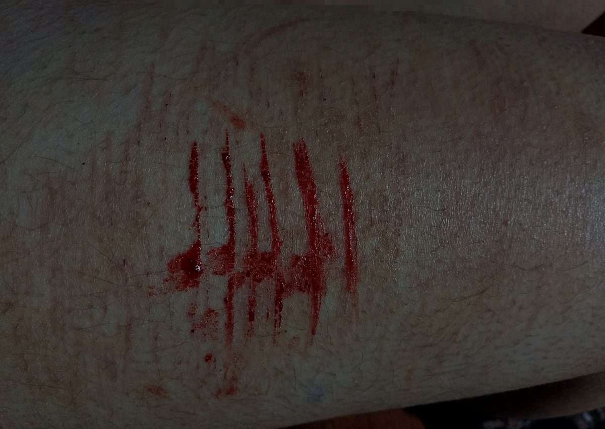 sidsidseed's tweet photo. fake makeup practice Halloween sfx https://t.co/qZS8T58ptN