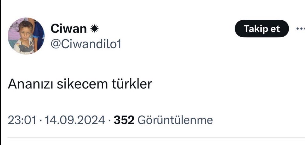 icoline33_'s tweet photo. kaset öyle çekilmez böyle çekilir https://t.co/R82cXfaoST