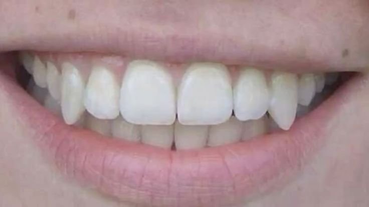 acervorindou's tweet photo. 愛𝅙𝅙✿꯭🥢 𓈒    ﹒  𝐂aracterísticas 𖢷
  ➥ Uma cicatriz na boca — quase invisível, dentes caninos um pouco afiados, cilios longos e covinha de só um lado do sorriso https://t.co/hfb8cVjK5a
