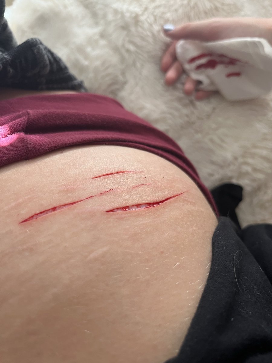 kaburamarustwin's tweet photo. FAKE! SFX MAKEUP FOR HALLOWEEN

#redinktwt #redink #shtwt #shedtwt #shrtwt #shtwtt #shedrtwt #shedtwtt #slitwt #slittwt #slitwtt https://t.co/Rl263RuF1X
