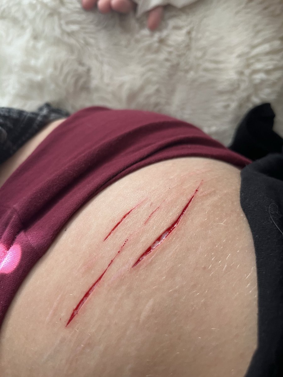 kaburamarustwin's tweet photo. FAKE! SFX MAKEUP FOR HALLOWEEN

#redinktwt #redink #shtwt #shedtwt #shrtwt #shtwtt #shedrtwt #shedtwtt #slitwt #slittwt #slitwtt https://t.co/Rl263RuF1X