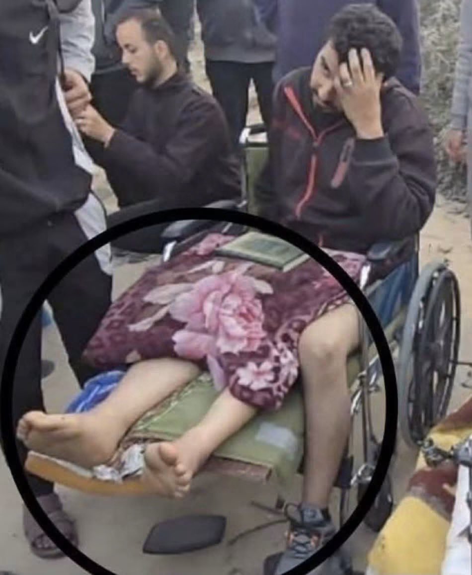 sabra_the's tweet photo. After the "genocide and the starvation," now they suffer from third-leg syndrome.

Pallywood. https://t.co/dTP6A8I1Co