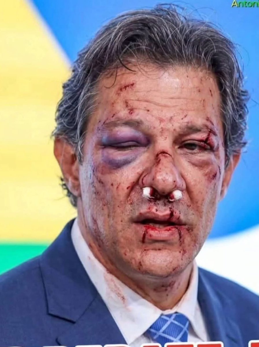RosaneBonoro's tweet photo. Estraçalharam com ele. https://t.co/F1dHoCTltM