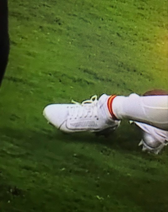 HolyShotTV's tweet photo. Tyquan Thornton' Ankle after the play. Prayers 🙏 https://t.co/44uFTqwlcd