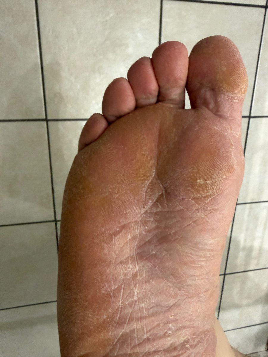 Real_NoFilter's tweet photo. Should I get a pedi and moisturise or do you like them dry and rough? https://t.co/9cELUjYztU