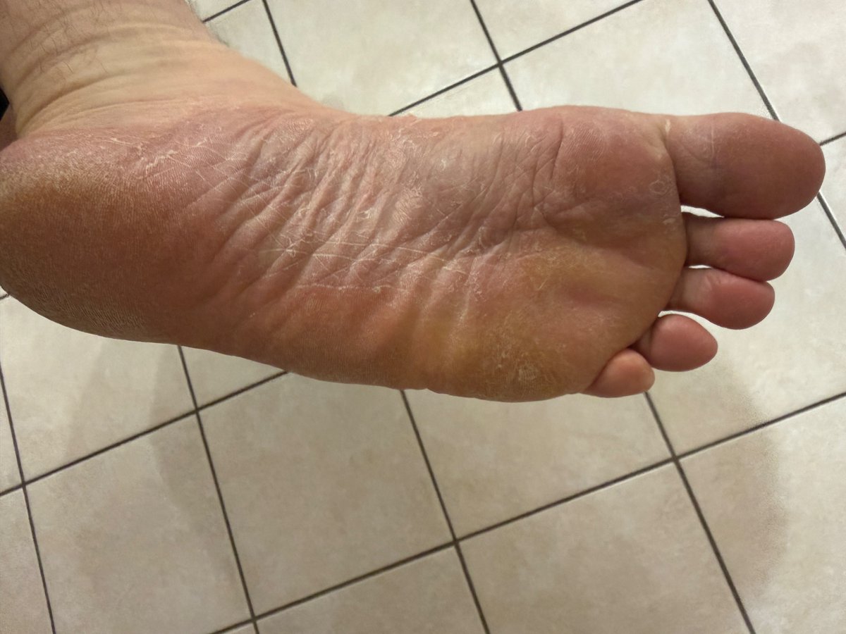Real_NoFilter's tweet photo. Should I get a pedi and moisturise or do you like them dry and rough? https://t.co/9cELUjYztU