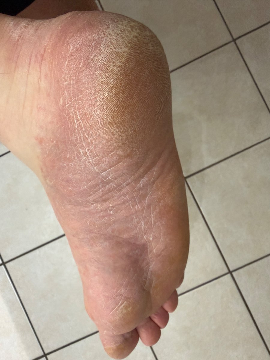 Real_NoFilter's tweet photo. Should I get a pedi and moisturise or do you like them dry and rough? https://t.co/9cELUjYztU