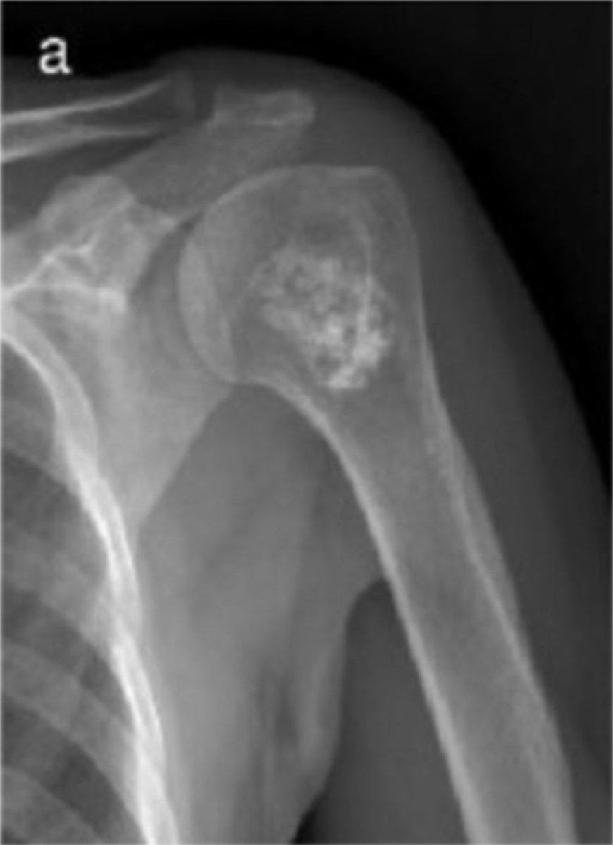 jppathpd's tweet photo. Dx? bone HE #pathkeys https://t.co/0TOdgRGNbK