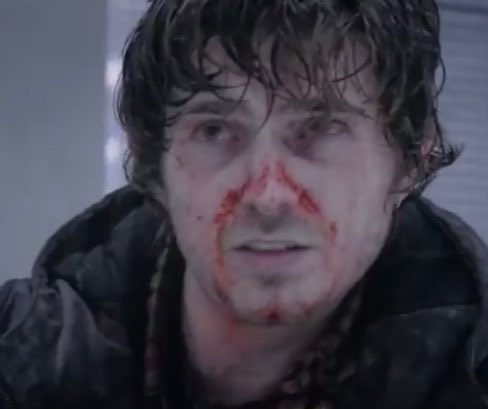 sleckiversz's tweet photo. why does he look so good covered in blood and pale as snow like im really gonna fuck him till we fuse together https://t.co/WqVeLVzbnq