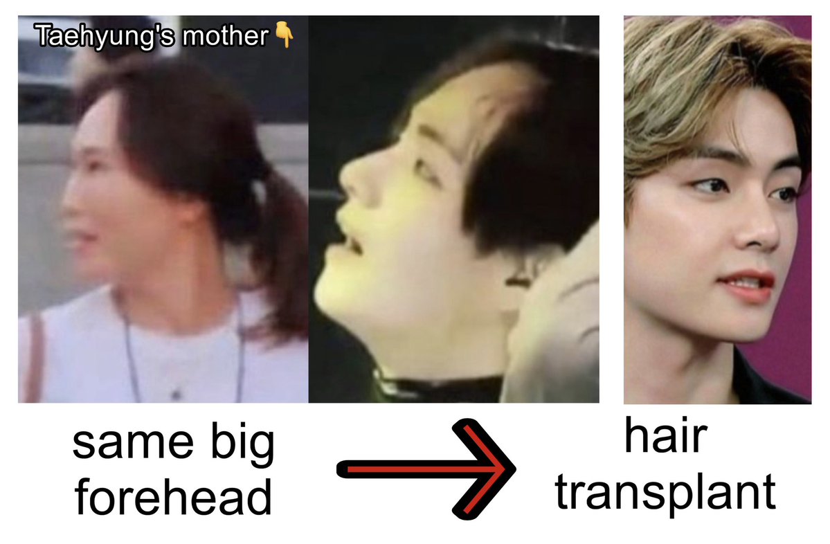 begativee's tweet photo. @king0fkp0pthv @residentevxn bro you stan baldhyung botched nose big ears deafhyung vglyhyung ogrehyung pedohyung
you should be the last trash talking jungkook’s look https://t.co/0kWwNhcxct
