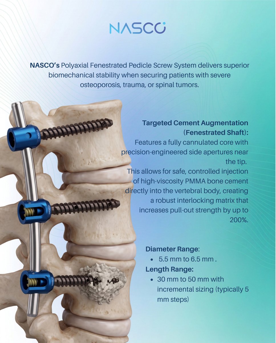 NascoSurgitech's tweet photo. NASCO's Poly Axial Fenestrated Pedicle Screw (STAR) up to 200% higher pull-out strength with targeted PMMA cement augmentation. Built for osteoporotic, trauma &amp; tumor spine cases.

🌐 https://t.co/ki1g6Ki9PK
📩 export@nascosurgitech.com
#SpineSurgery #SpinalImplants #PedicleScrew https://t.co/16rKcnPMsd
