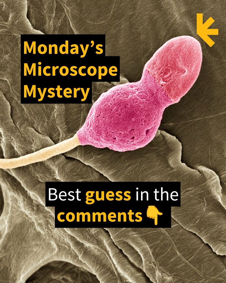 ScienceAlert's tweet photo. So what do you think this is? 🔬👀

Is it a Dr. Seuss character? A strange balloon? A tiny tennis racket?

Zoom in, take your best shot, and drop your guess below. Wrong answers are strongly encouraged. 😂

We'll put you out of your misery tomorrow. 😏 https://t.co/qbBKlNsUSR