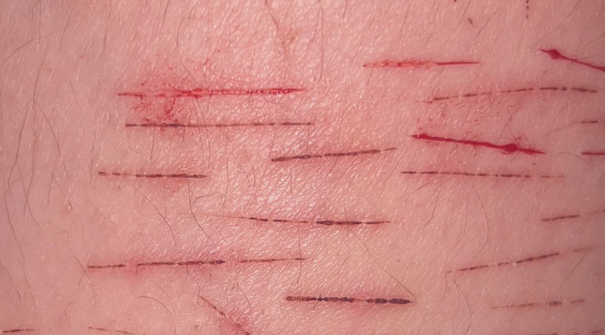 millepreak's tweet photo. idk how depths work what is this ^_^ also sorry for my hairy legs https://t.co/KTDKFBQy9J